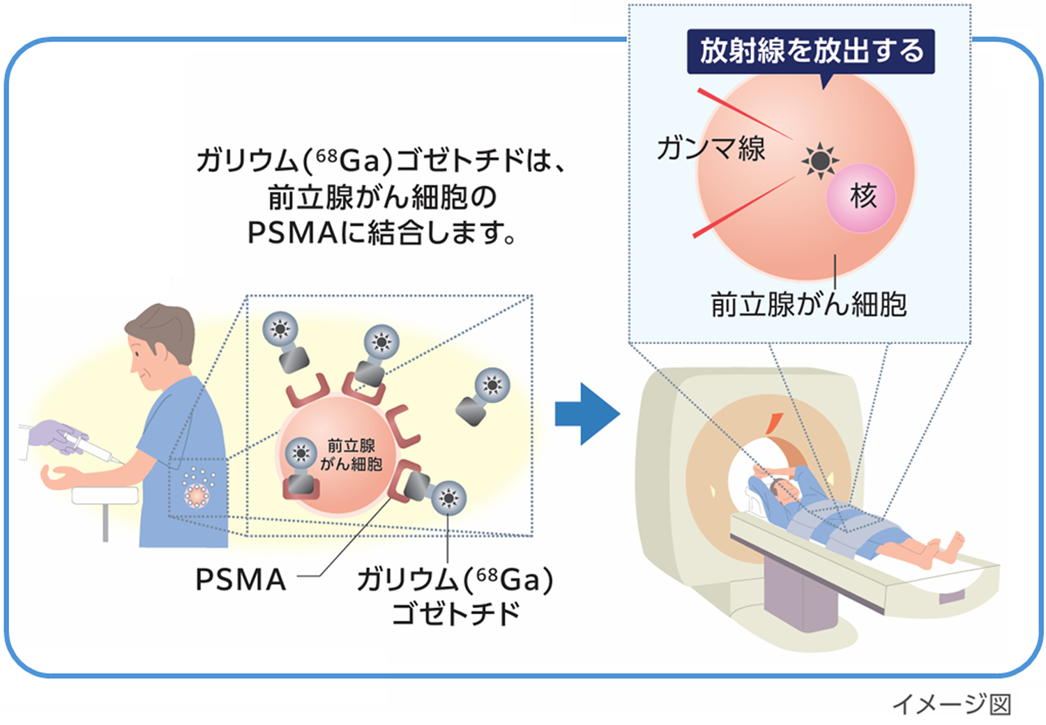 PSMA-PET検査とは？